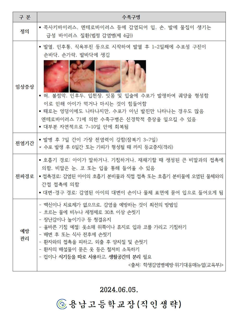 수두 및 수족구병 예방관리 안내002.jpg